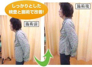 北小金の整体姿勢3